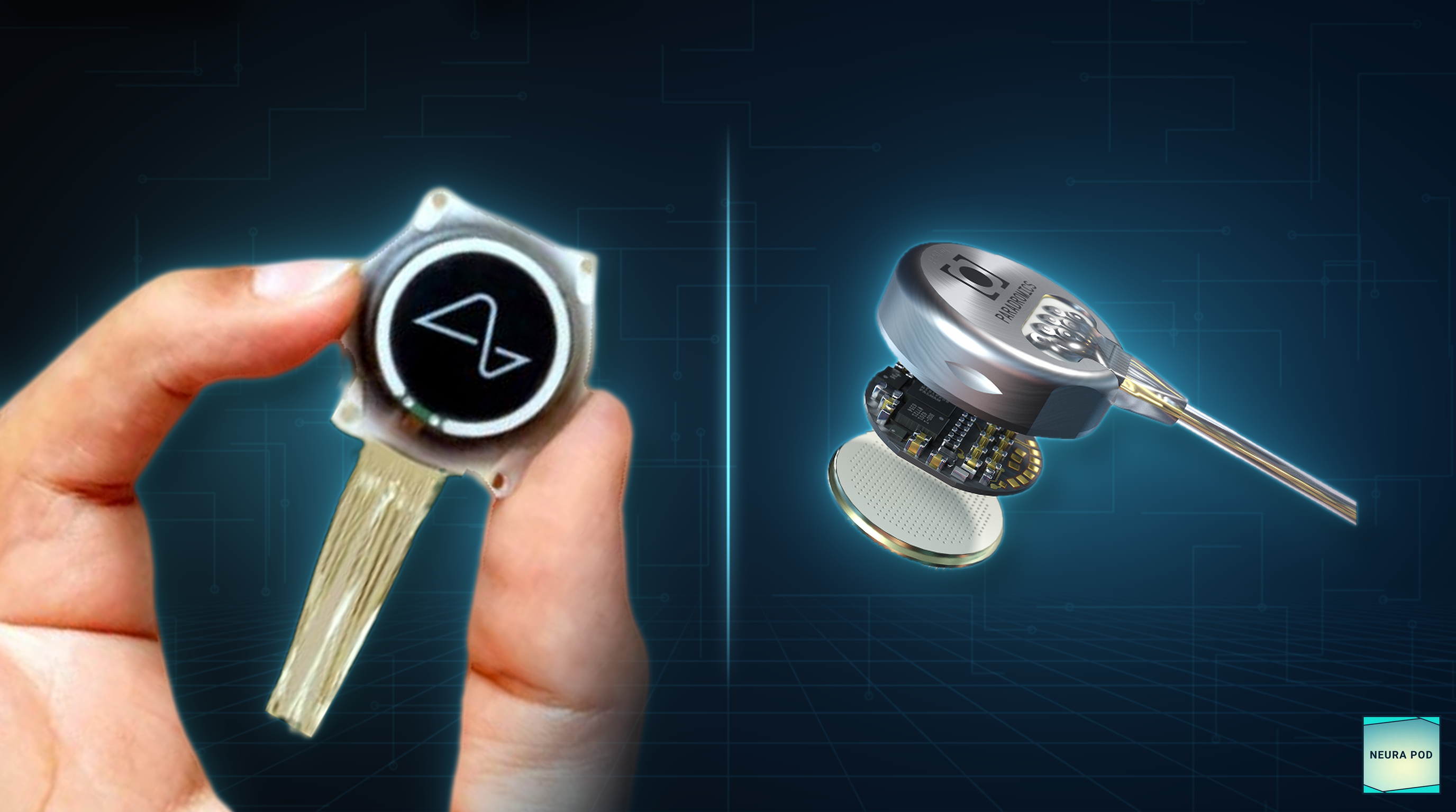 How Long Do Brain Implants Last? Paradromics vs. Neuralink